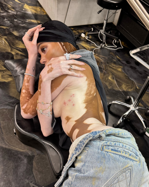 Winnie Harlow instagram post 487406