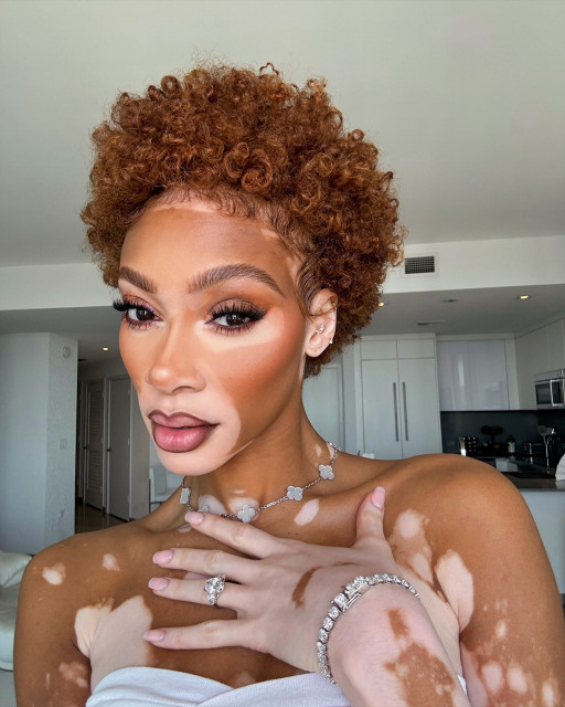 Winnie Harlow instagram post 487999