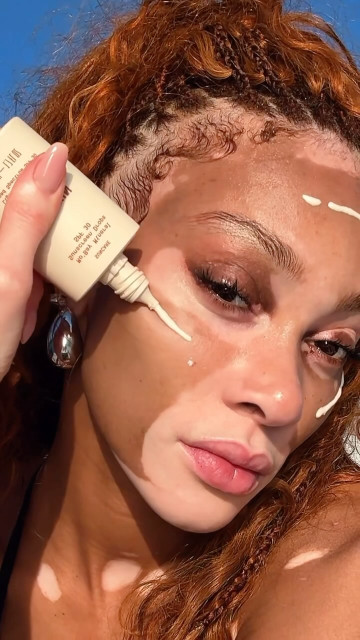 Winnie Harlow instagram post 488431