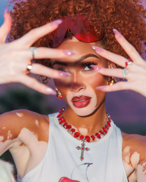 Winnie Harlow instagram post 489284