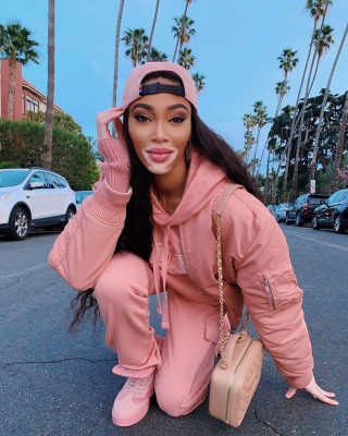 photo 20 in Winnie Harlow gallery [id1207692] 2020-03-20 00:00:00