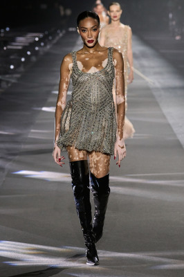 photo 4 in Winnie Harlow gallery [id1330299] 2023-07-21 00:00:00