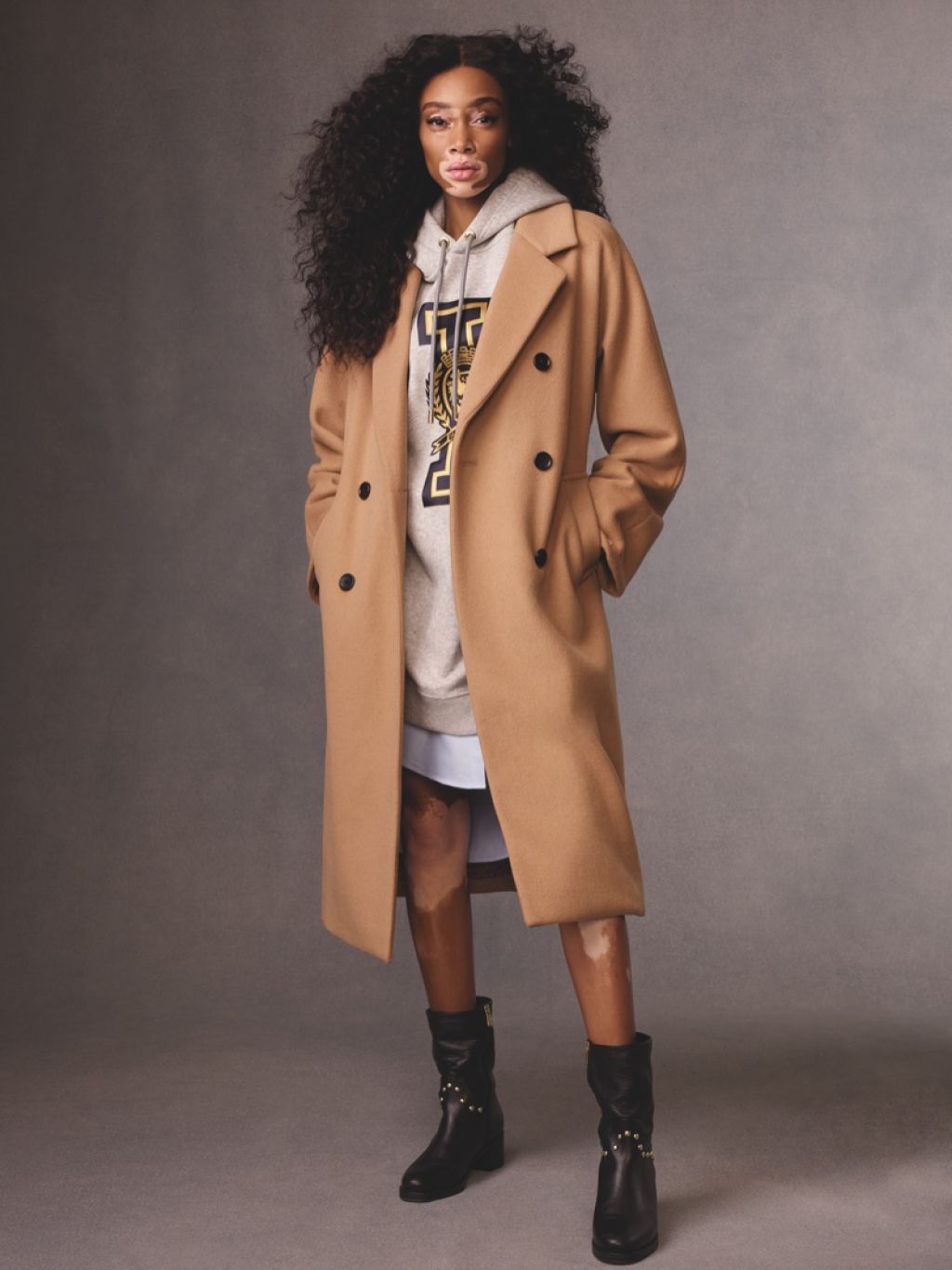 Winnie Harlow, photo #1061564