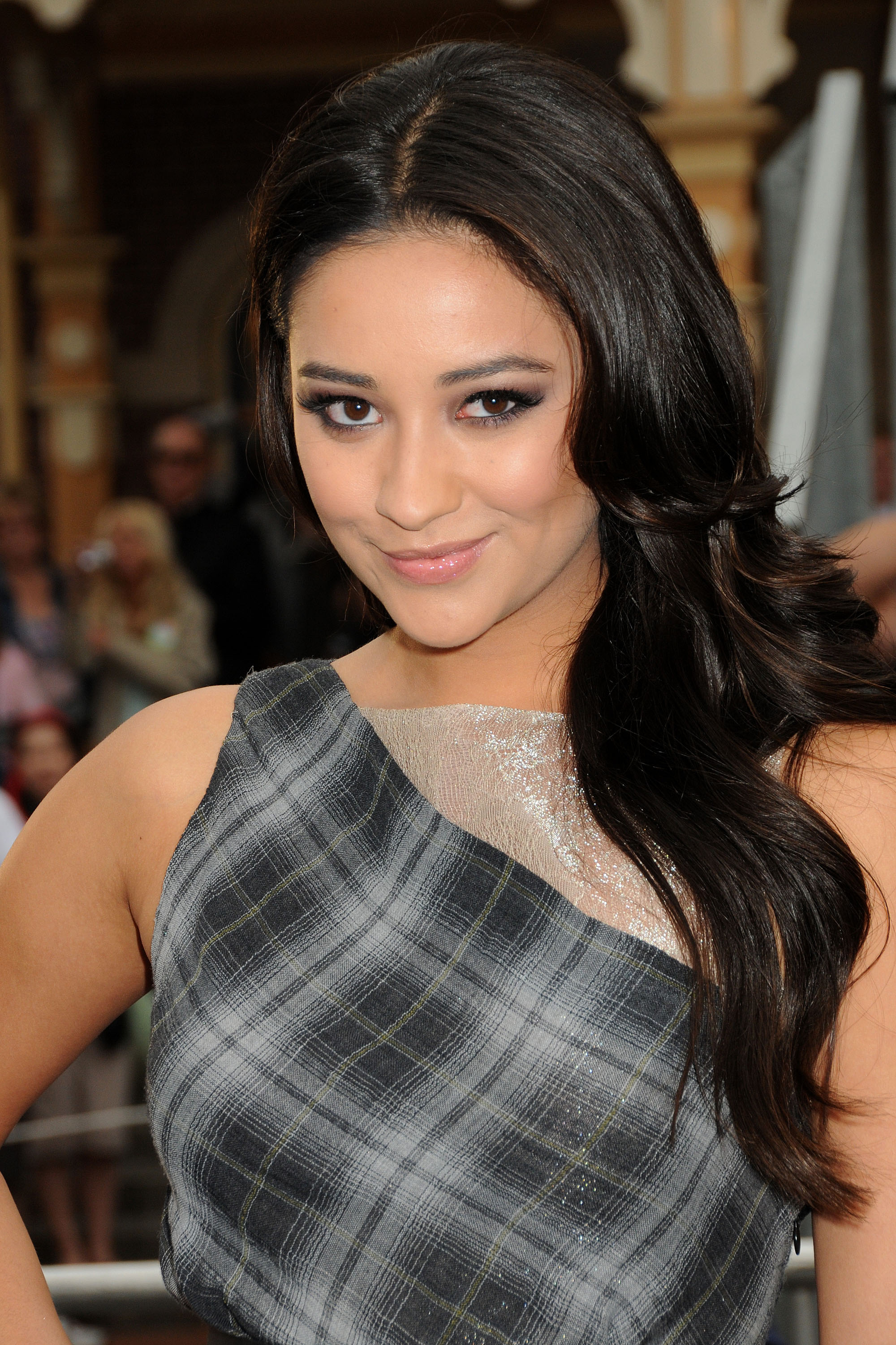 Shay Mitchell lost tooth